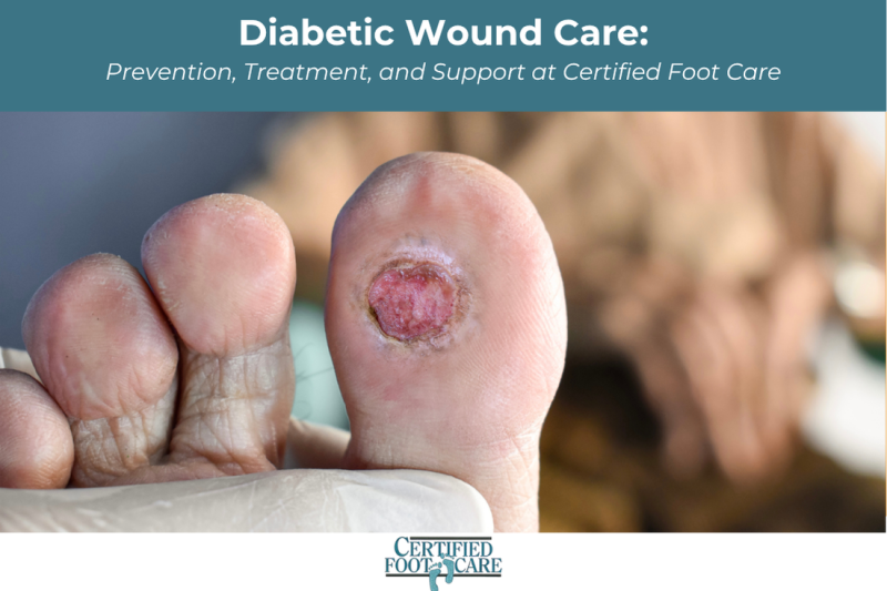 Diabetic Wound Care Prevention, Treatment, and Support at Certified Foot Care